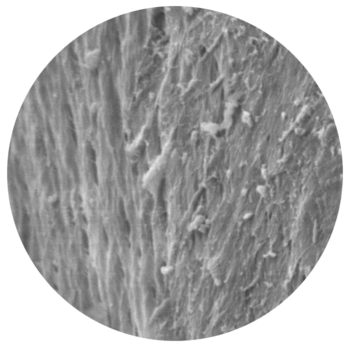 SEM image of MinerOss A at 5000x magnification shows the macroporous structure (botiss biomaterials).