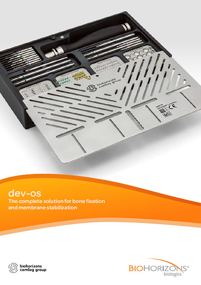dev-os image flyer dev-os The complete solution for bone fixation and membrane stabilization